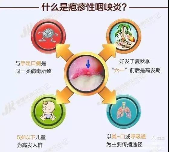 皰疹性咽峽炎及手足口病不用慌，紫外線燈來幫忙