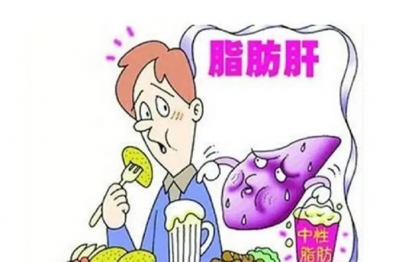 體檢查出輕度脂肪肝？想要逆轉需要做到這幾點